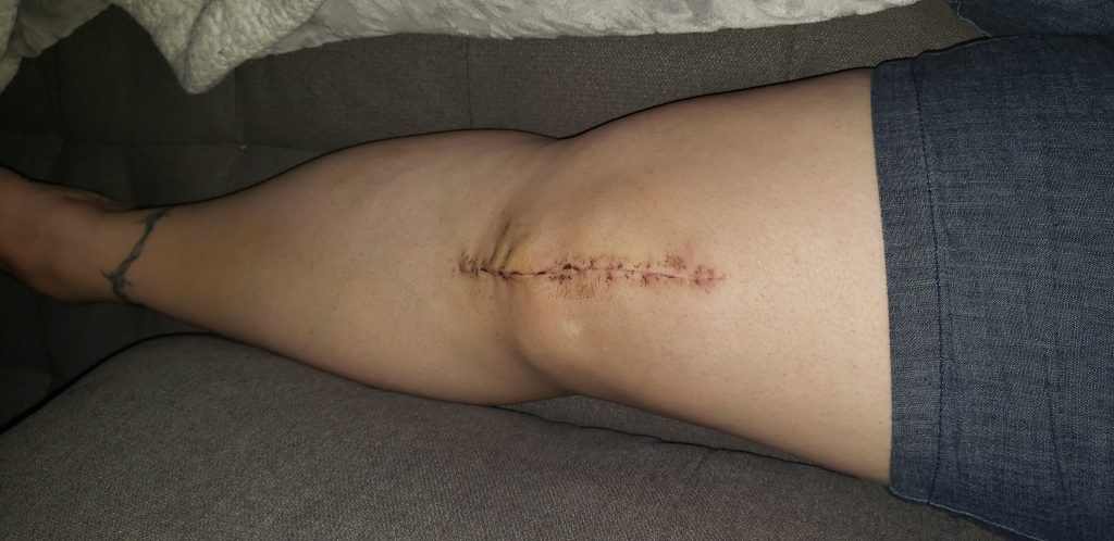 Patient image of: Elizabeth Flores