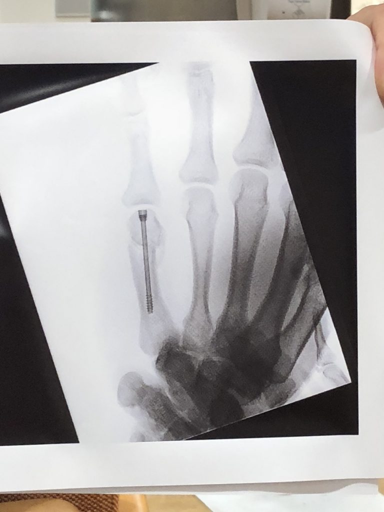 Patient image of: Ryan Granito