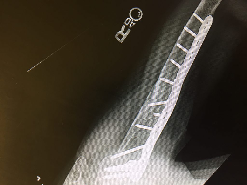 Patient image of: Susan Weinstein