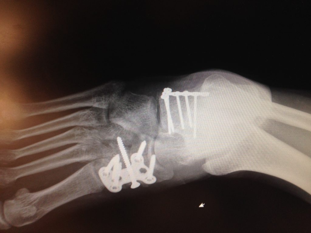 Patient image of: Lexy Jones