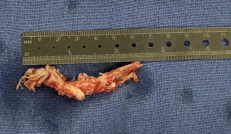 Patient image of: April Resnick