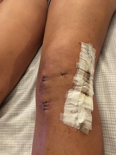 Patient image of: Windy Johnson