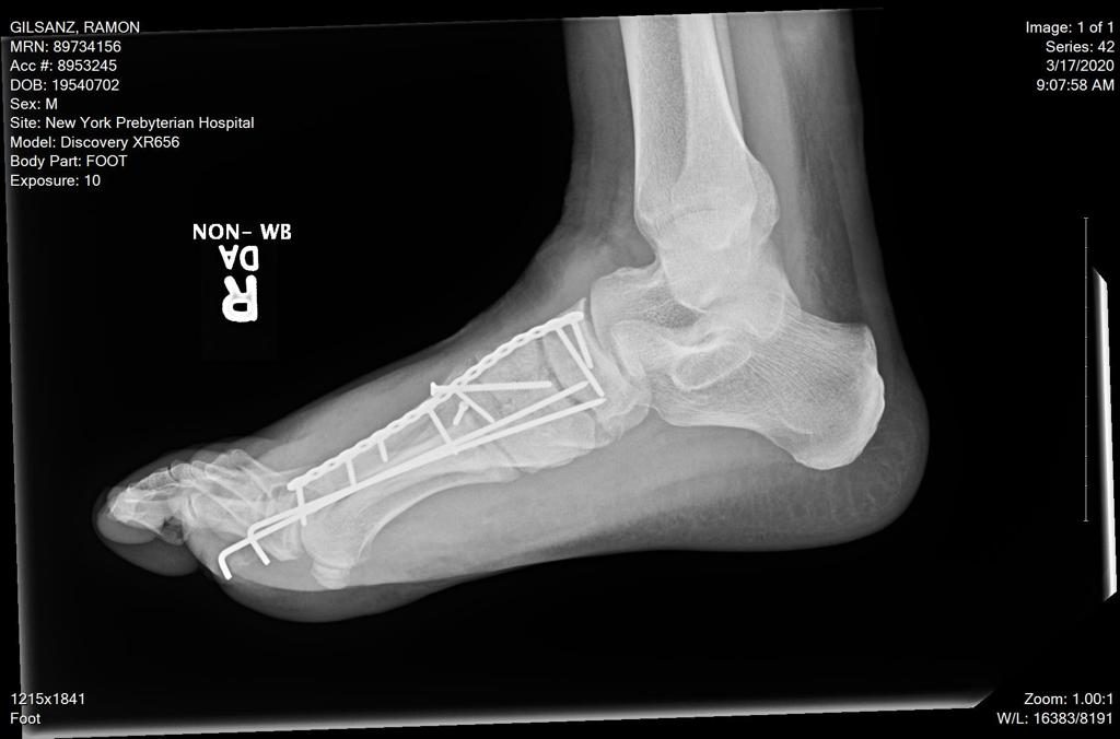 Patient image of: Ramon Gilsanz