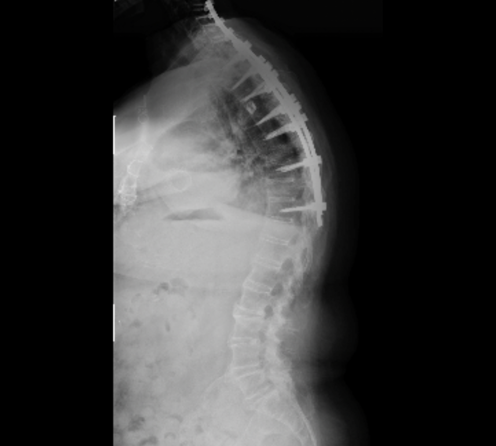 Patient image of: Susan 