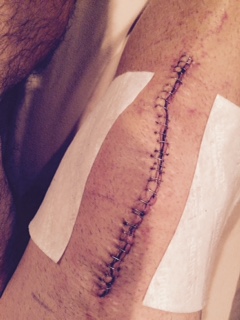 Patient image of: Matthew Willing
