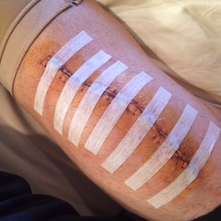 Patient image of: Matthew Willing