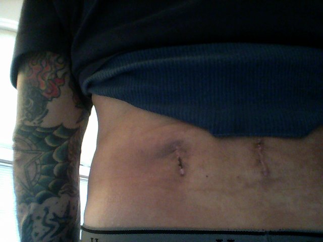 Patient image of: Christopher Cardinoza